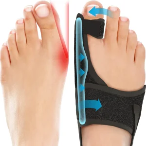 Orthopedic Bunion Splint Corrector